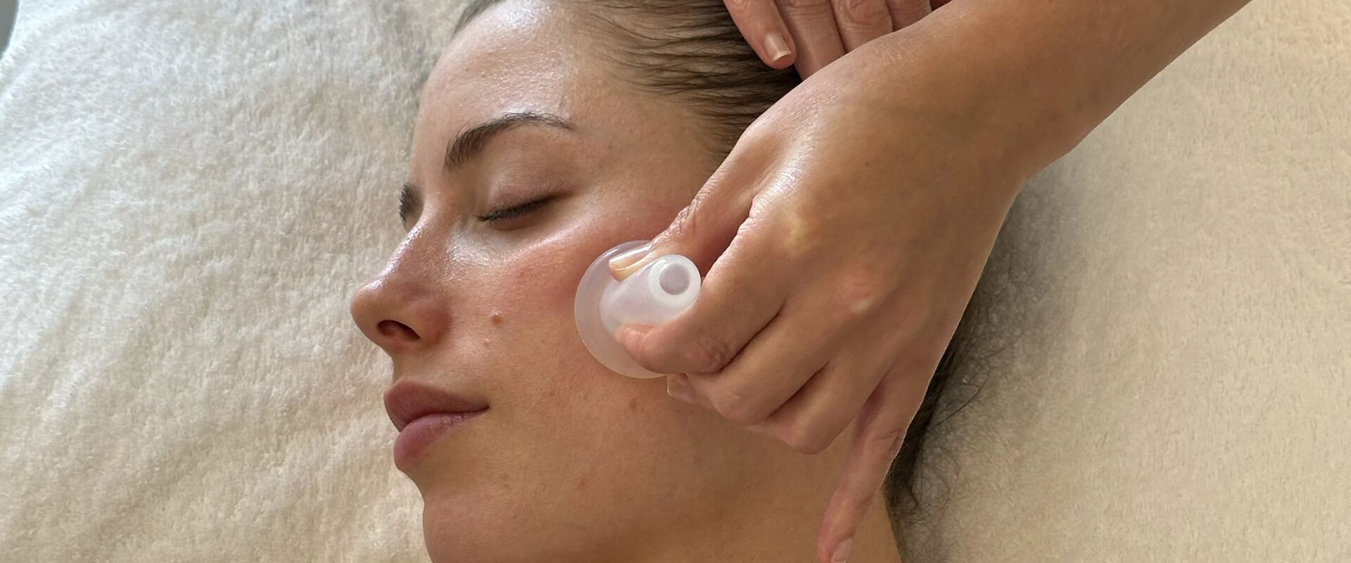 facial cupping benefits, how it works, and what to expect